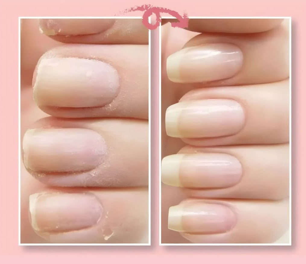 NailRevive™ | Cracked Nail Repair Gel (1+1 FREE)